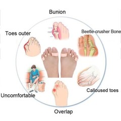 2-4pcs Hallux Valgus Silicone Toe Corrector Separator Spacer Avoid Toe Squeezing