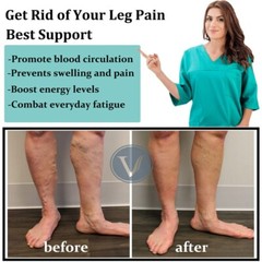 Copper Compression Socks Knee High Support Stockings Full Toe 20-30 mmHg Unisex