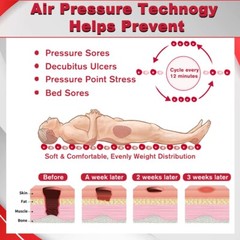Hospital Bed Alternating Air Pressure Mattress Pad Quiet Pump Relieve Bedsore