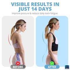 MATINNE Posture Corrector for Women & Men – Adjustable Back Large, Black
