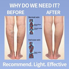 Open Toe Compression Socks for Women Men 15-20 Mmhg 4 Pairs Toeless Footless Soc