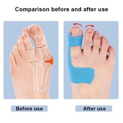 10PCS Precut Kinesiology Tape for Bunion,Bunion Corrector & Relief,Big Toe