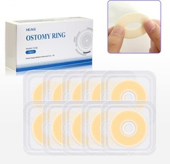 Protective Ostomy Bag Seal Rings 2–4mm Moldable Hydrocolloid Barrier 10 or 30PCS