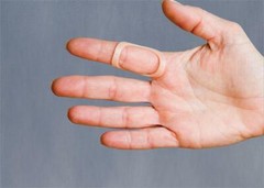 3PP Oval-8 Finger Splints Graduated Set (5 Pack)