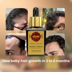 EKMIVEDA Hair Growth DHT Blocker Serum, Redensyl, Procapil, Ayurvedic Herbs