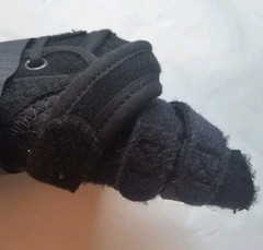 Breg Apollo Universal Wrist Brace with Thumb Spica – RIGHT Hand