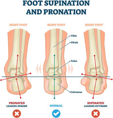 Pedag Correct German Made Medial and Lateral Wedge Heel Straightener Insert