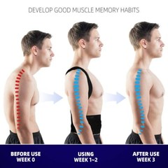 Posture Corrector Back Brace for Women Men, Scoliosis and Hunchback Correction