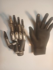 Ossur I-Limb Ultra Bionic L Hand, Silicone Hand Cover and Home Charger