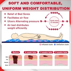 New Hospital Bed Alternating Pressure Mattress Pad Quiet Pump Relieve Bedsore