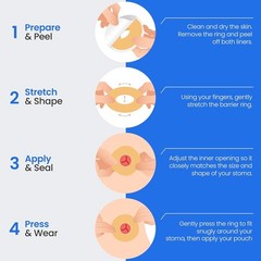 High-Tact & Stretchable 2″ Adhesive Stoma Seals – 10 Count for Comfort & Fit