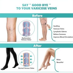 Compression Thigh High Stockings Men and Women 20-30 mmHg Beige Black Large