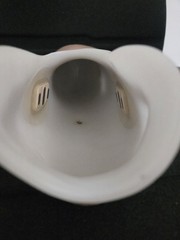 Lot of Three (3) Right Below Elbow Prosthetic Arms – Myoelectric, Parts, Collect