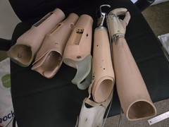 Lot of Five (5) Left Below Elbow Prosthetic Arms – Myoelectric & Body-Powered