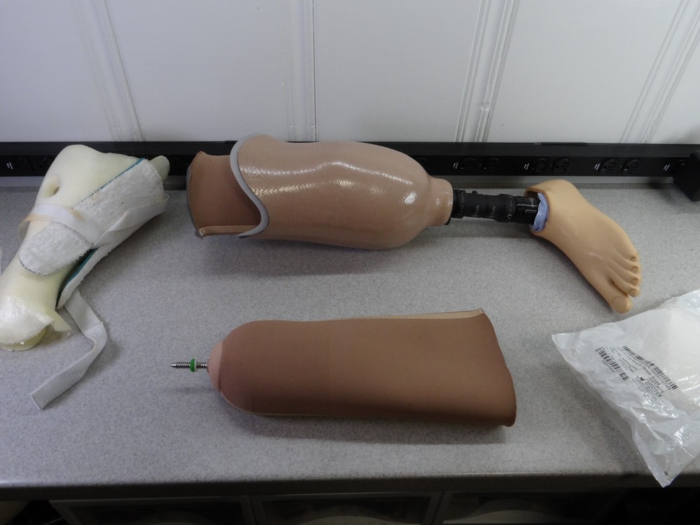 Left Leg Prostetic w/Foot Endolite Avalon K2 & Adjustable Trulife Bar – Size 26