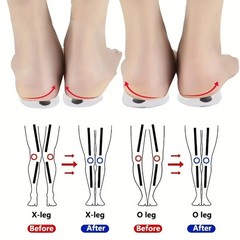 Orthopedic Pair 1 Insole for OX Leg Correction Gel Massage Support Shoe Pad