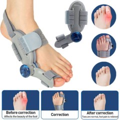 Treatment Bunion Fix ,Toe Valgus Corrector Adjustable Orthosis Women Men Splints
