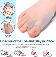 Soft Silicone Gel Bunion Pads – 8 Pack for Big Toe Comfort & Alignment