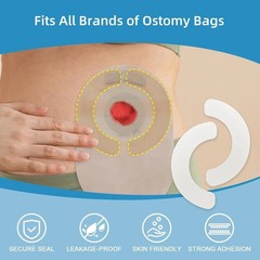 KONWEDA Ostomy Barrier Strips Elastic Barrier For Colostomy Bags Pack Of 10 …