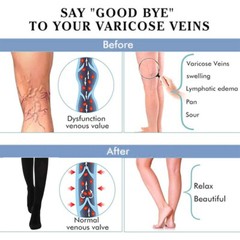 Tight Stocking Gradient Compression Support Pantyhose for Varicose Veins US