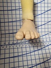Complete Prosthetic Left Leg Knee WillowWood Limblogic Trulife Adult Dallas Cowb