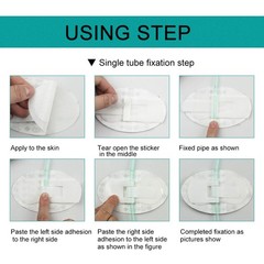 Body Surface Catheter Fixation Devices Non Woven Fabric Infusion Tube Fixed