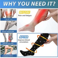Compression Socks Stockings Womens Mens Over Knee Medical 15-20 mmHG S/M-X/XL