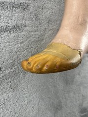 Vintage Left Above Knee Prosthetic Leg Please Read