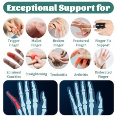 5 Pcs Trigger Thumb Splints, Finger Brace for Straightening or Support