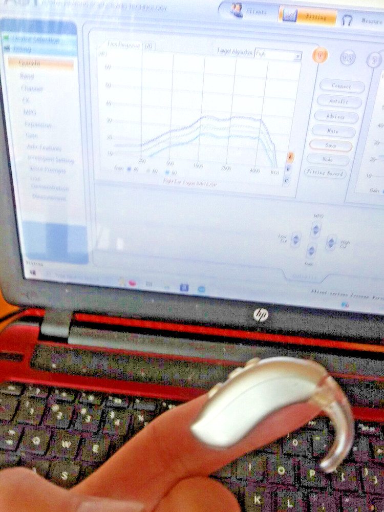 PROGRAMMABLE BEHIND THE EAR DIGITAL HEARING AID PROFOUND hearing loss BUY USA
