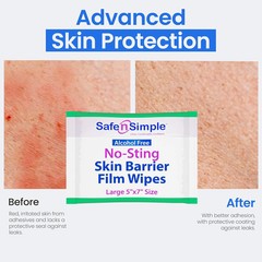 Safe n‘ Simple Large Skin Barrier Wipes No-Sting – 5″ x 7″ – 25 Count – Alcohol-