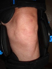 Nvorliy Knee Brace for Functional Posterior Cruciate Ligament Recovery Med left