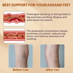 2 Pairs Compression Stockings for Women & Men, L, 2 Beige&Black