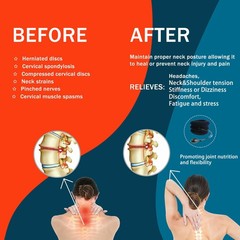 Cervical Neck Traction Device Collar Brace Support Pain Relief Stretcher Therapy