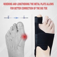 MOONSMILE 1 Pair Foot Bunion Corrector for Women & Men, Night Bunion Splint, …