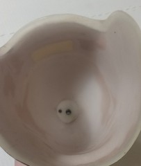 Left Below Knee BK Prosthetic Socket w/ 3R80 Connector Expulsion Valve & Liner