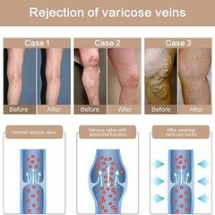 Therapy 20-30 mmHg Firm Support Gradient Compression Tights Pantyhose Stockings